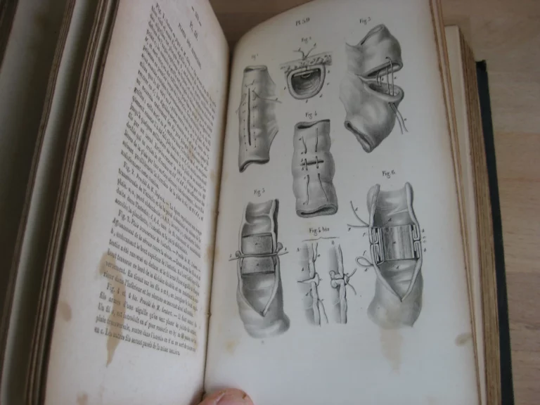 Précis iconographique de médecine opératoire et d’anatomie chirurgicale