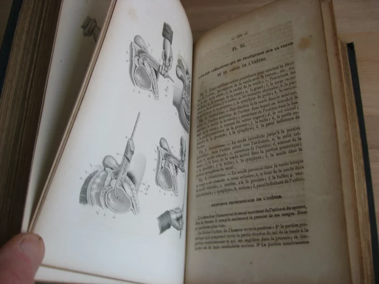 Précis iconographique de médecine opératoire et d’anatomie chirurgicale