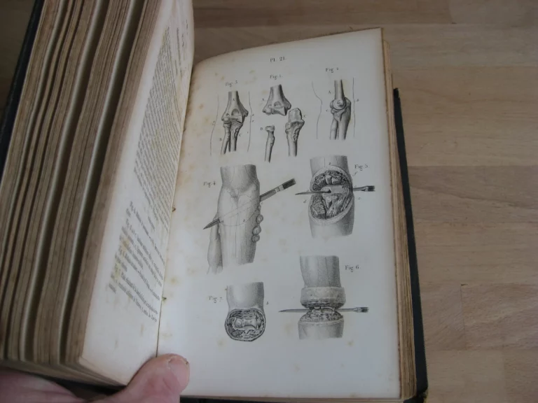 Précis iconographique de médecine opératoire et d’anatomie chirurgicale