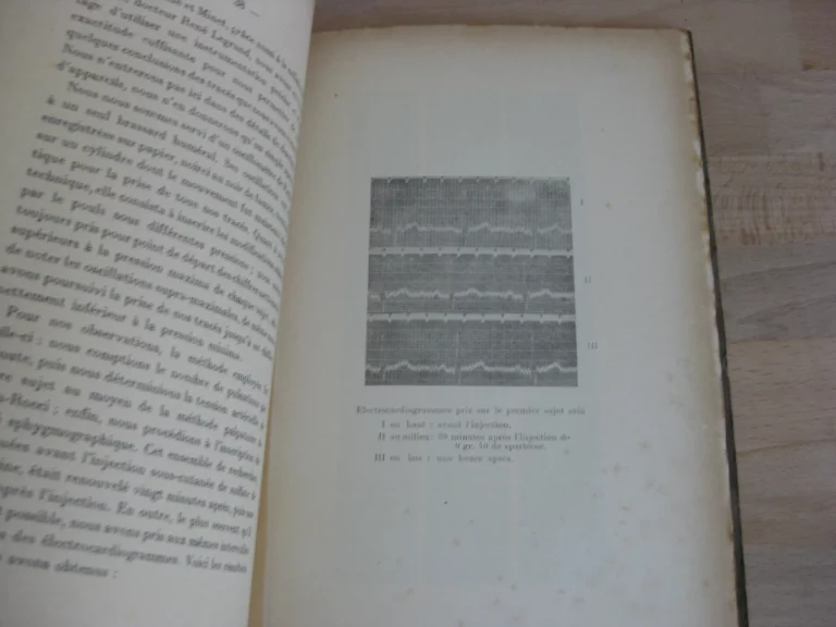 De la spartéine en thérapeutique cardiaque - Dr. Henry Bulteau De la spartéine en thérapeutique cardiaque - Dr. Henry Bulteau